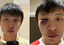 حمله وحشیانه به جوان سنگاپوری به بهانه کرونا در لندن